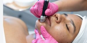 Acne & Scar Treatment Acne & Scar Treatment